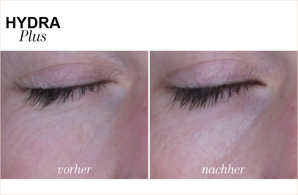 Ampullen fürs Gesicht Wirkung & Anwendung BABOR